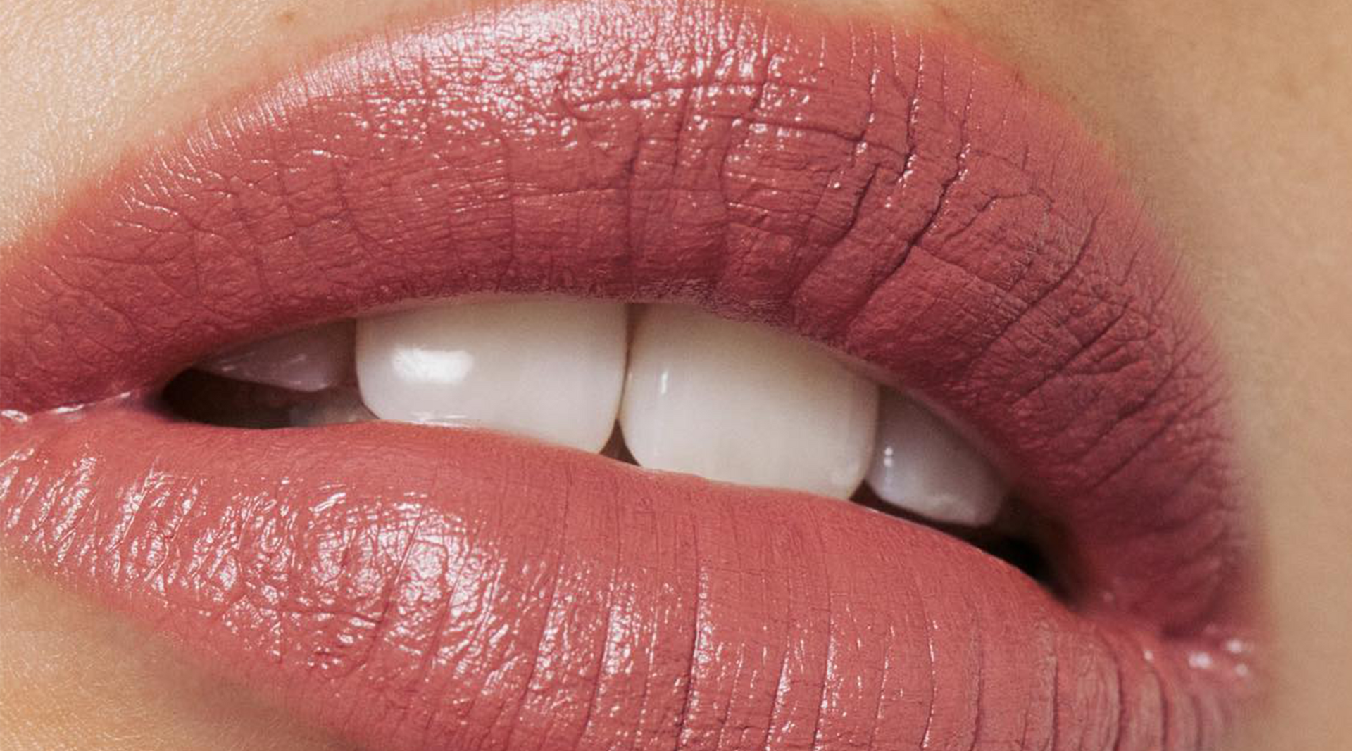 A Derm’s Guide to Treating Dry, Cracked Lips